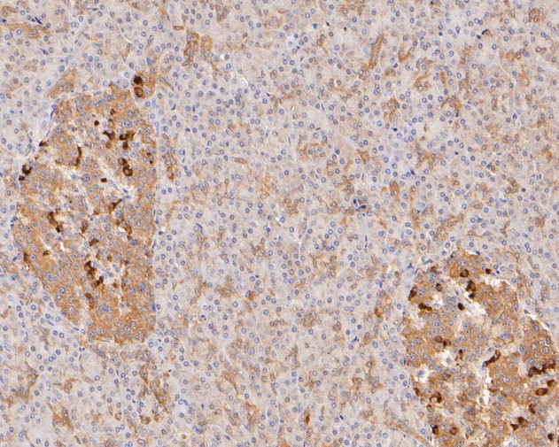 Fig5:; Immunohistochemical analysis of paraffin-embedded human pancreas tissue using anti-SLFN12 antibody. The section was pre-treated using heat mediated antigen retrieval with Tris-EDTA buffer (pH 8.0-8.4) for 20 minutes.The tissues were blocked in 5% BSA for 30 minutes at room temperature, washed with ddH; 2; O and PBS, and then probed with the primary antibody ( 1/50) for 30 minutes at room temperature. The detection was performed using an HRP conjugated compact polymer system. DAB was used as the chromogen. Tissues were counterstained with hematoxylin and mounted with DPX.