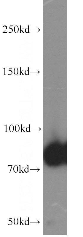 human skeletal muscle tissue were subjected to SDS PAGE followed by western blot with Catalog No:113772(PFKM antibody) at dilution of 1:800