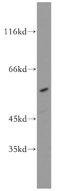 MCF7 cells were subjected to SDS PAGE followed by western blot with Catalog No:115722(STK38 antibody) at dilution of 1:500