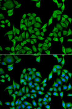 Immunofluorescence - UGT1A1 Polyclonal Antibody 