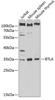 Western blot - BTLA Polyclonal Antibody 
