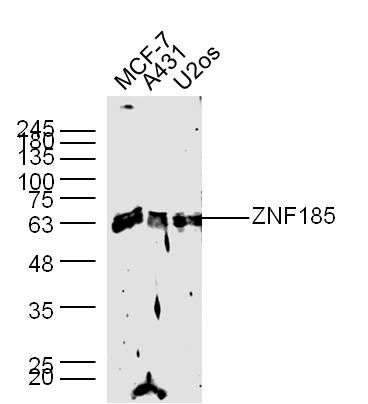Fig1: Sample:; MCF-7(Human) Cell Lysate at 40 ug; A431(Human) Cell Lysate at 40 ug; U2os(Human) Cell Lysate at 40 ug; Primary: Anti-ZNF185 at 1/300 dilution; Secondary: IRDye800CW Goat Anti-Rabbit IgG at 1/20000 dilution; Predicted band size: 76/39 kD; Observed band size: 67 kD