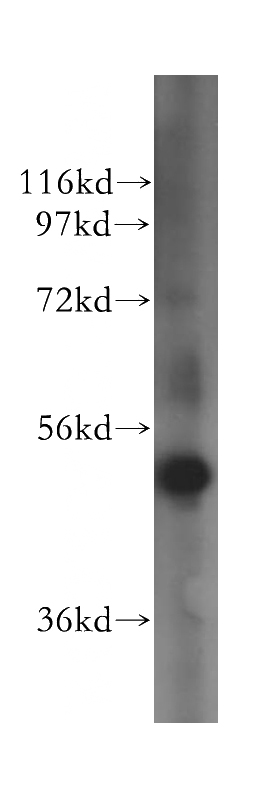 mouse pancreas tissue were subjected to SDS PAGE followed by western blot with Catalog No:107972(ALDH5A1 antibody) at dilution of 1:500