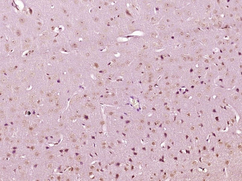 Fig2: Paraformaldehyde-fixed, paraffin embedded (Mouse brain); Antigen retrieval by boiling in sodium citrate buffer (pH6.0) for 15min; Block endogenous peroxidase by 3% hydrogen peroxide for 20 minutes; Blocking buffer (normal goat serum) at 37℃ for 30min; Antibody incubation with (Deltex) Polyclonal Antibody, Unconjugated at 1:400 overnight at 4℃, followed by operating according to SP Kit(Rabbit) (sp-0023) instructionsand DAB staining.