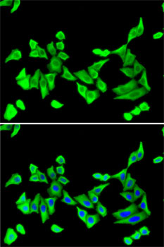 Immunofluorescence - PTH Polyclonal Antibody 
