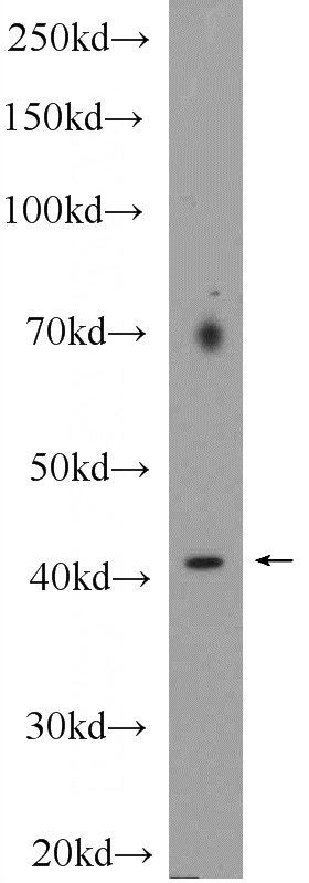 HeLa cells were subjected to SDS PAGE followed by western blot with Catalog No:115581(SPOP Antibody) at dilution of 1:600