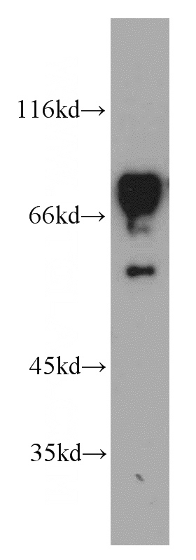 HEK-293 cells were subjected to SDS PAGE followed by western blot with Catalog No:115141(SF4 antibody) at dilution of 1:1000
