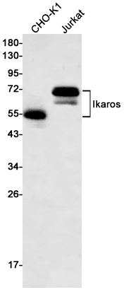 Western blot detection of Ikaros in CHO-K1,Jurkat cell lysates using Ikaros Rabbit mAb(1:500 diluted).Predicted band size:58kDa.Observed band size:50-70kDa.