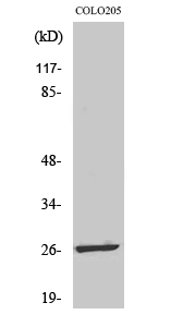 Fig1:; Western Blot analysis of various cells using LDOC1L Polyclonal Antibody