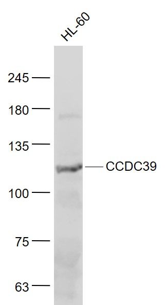 Fig2: Sample:; HL-60(Human) Cell Lysate at 30 ug; Primary: Anti- CCDC39 at 1/1000 dilution; Secondary: IRDye800CW Goat Anti-Rabbit IgG at 1/20000 dilution; Predicted band size: 110 kD; Observed band size: 110 kD