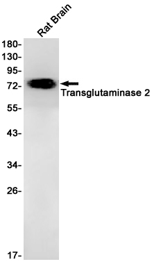 Western blot detection of Transglutaminase 2 in Rat Brain lysates using Transglutaminase 2 Rabbit pAb(1:1000 diluted).Predicted band size:77kDa.Observed band size:77kDa.