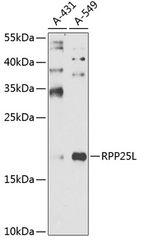 Western blot - RPP25L Polyclonal Antibody 