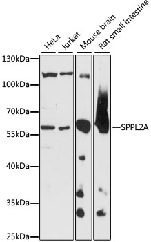 Western blot - SPPL2A Polyclonal Antibody 