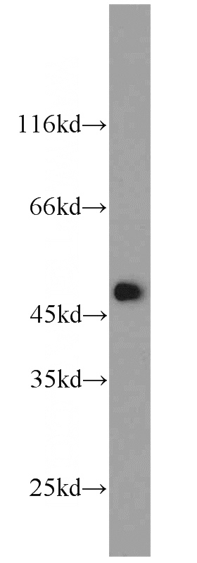 HEK-293 cells were subjected to SDS PAGE followed by western blot with Catalog No:110568(FCHSD1 antibody) at dilution of 1:1000
