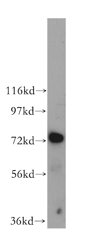 HeLa cells were subjected to SDS PAGE followed by western blot with Catalog No:116853(WDFY4 antibody) at dilution of 1:500