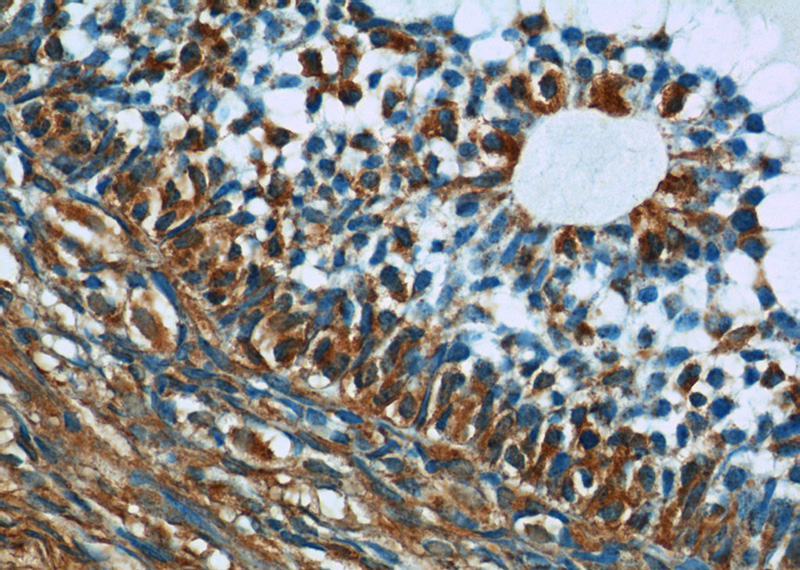 Immunohistochemistry of paraffin-embedded human ovary tissue slide using Catalog No:110296(ECOP Antibody) at dilution of 1:50 (under 40x lens)