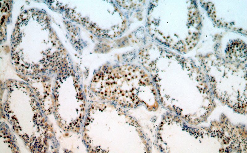 Immunohistochemical of paraffin-embedded human testis using Catalog No:114870(RUFY2 antibody) at dilution of 1:100 (under 10x lens)