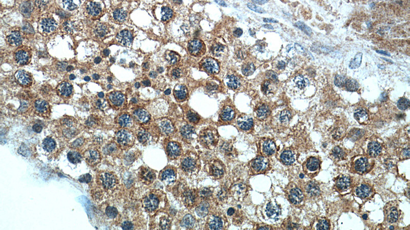 Immunohistochemical of paraffin-embedded human testis using Catalog No:108643(C11orf70 antibody) at dilution of 1:50 (under 40x lens)