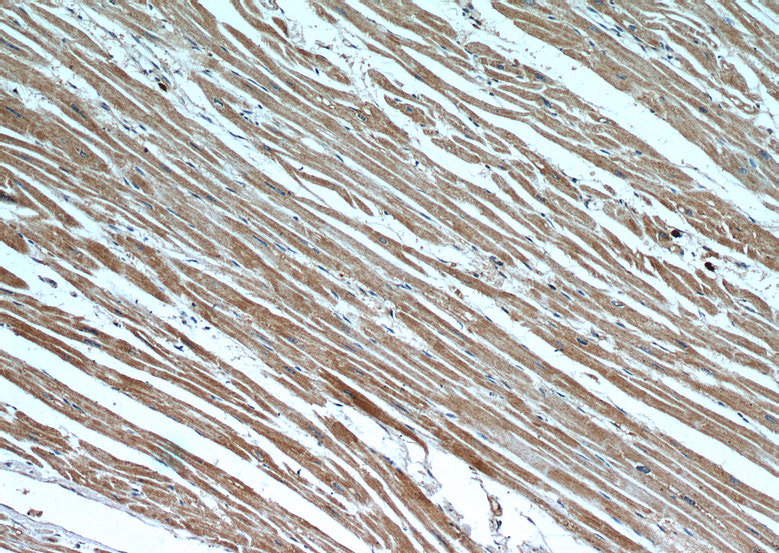 Immunohistochemistry of paraffin-embedded human heart slide using Catalog No:113243(NLRX1 Antibody) at dilution of 1:50