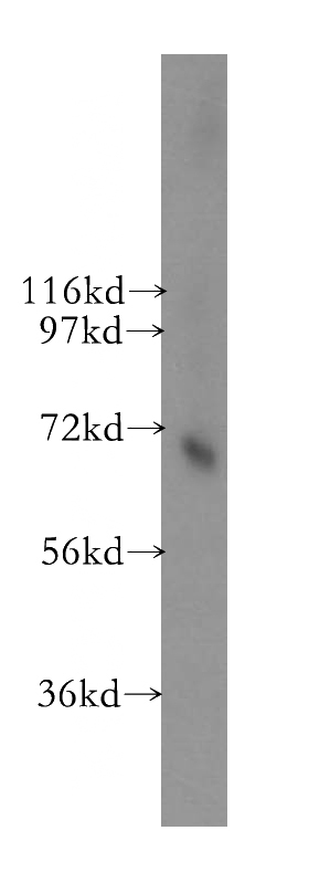 human brain tissue were subjected to SDS PAGE followed by western blot with Catalog No:116336(TKT antibody) at dilution of 1:300