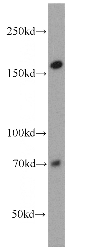 HepG2 cells were subjected to SDS PAGE followed by western blot with Catalog No:113030(NCAPD3 antibody) at dilution of 1:800
