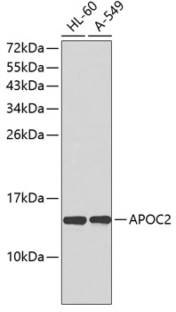 Western blot - APOC2 Polyclonal Antibody 