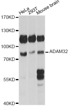 Western blot - ADAM32 Polyclonal Antibody 