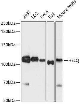 Western blot - HEL308 Polyclonal Antibody 