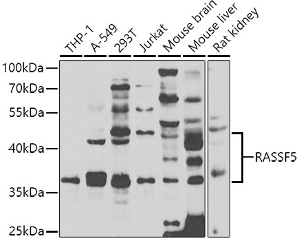 Western blot - RASSF5 Polyclonal Antibody 
