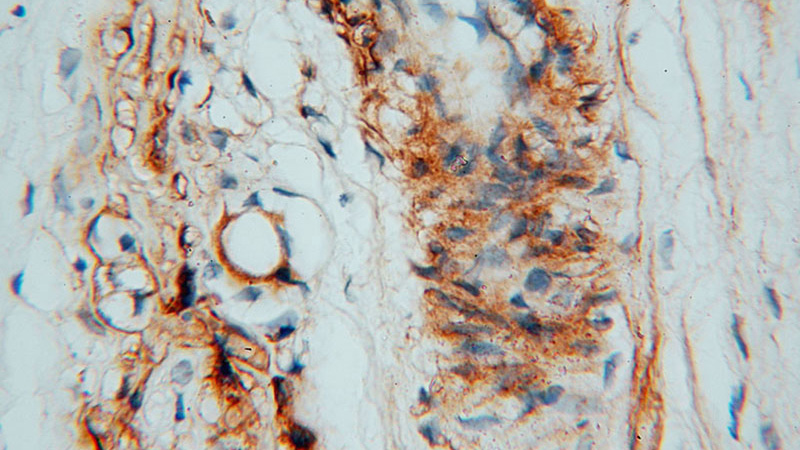 Immunohistochemical of paraffin-embedded human placenta using Catalog No:109596(CSHL1 antibody) at dilution of 1:100 (under 40x lens)