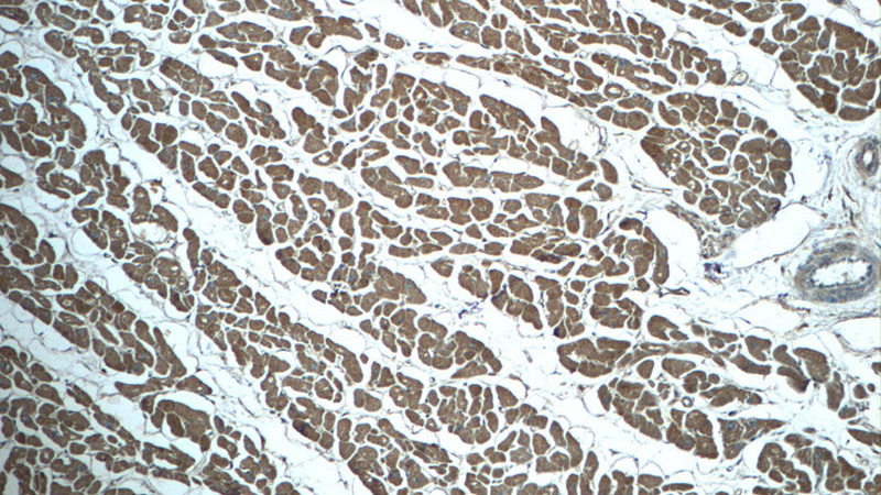 Immunohistochemistry of paraffin-embedded human heart tissue slide using Catalog No:113079(NDUFC1 Antibody) at dilution of 1:50 (under 10x lens)