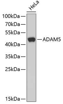 Western blot - ADAM5 Polyclonal Antibody 