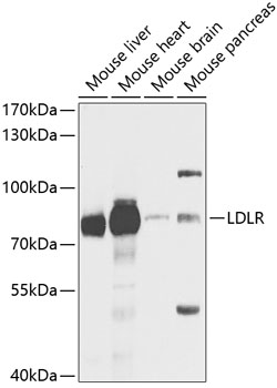 Western blot - IL31RA Polyclonal Antibody 