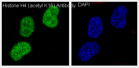 Immunofluorescent analysis of HeLa cells treated with TSA, using Histone H4 (acetyl K16) Antibody .