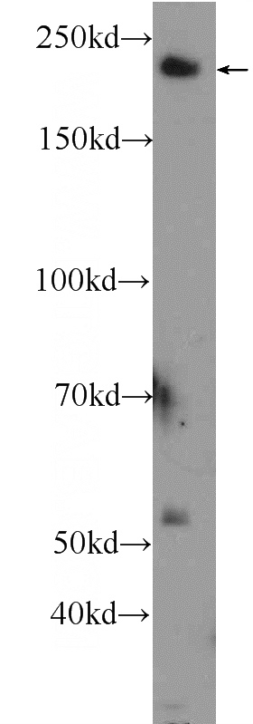 mouse brain tissue were subjected to SDS PAGE followed by western blot with Catalog No:114018(PLXNB1 Antibody) at dilution of 1:300