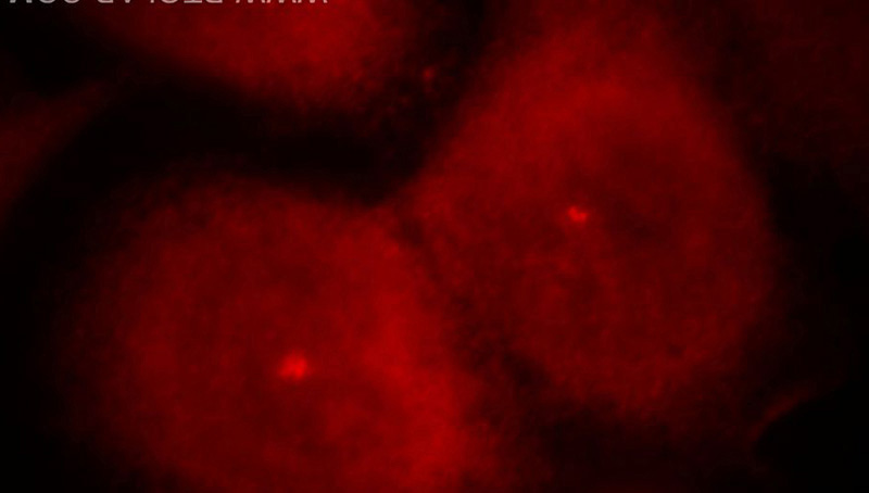 Immunofluorescent analysis of Hela cells, using WDR40A antibody Catalog No:116867 at 1:25 dilution and Rhodamine-labeled goat anti-rabbit IgG (red).
