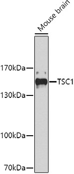 Western blot - TSC1 Monoclonal Antibody 