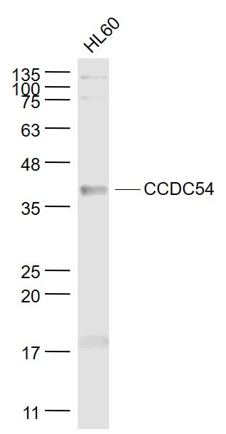 Fig2: Sample:; HL60(Human) Cell Lysate at 30 ug; Primary: Anti- CCDC54 at 1/1000 dilution; Secondary: IRDye800CW Goat Anti-Rabbit IgG at 1/20000 dilution; Predicted band size: 36 kD; Observed band size: 36 kD