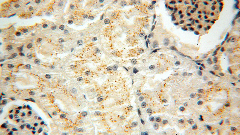 Immunohistochemical of paraffin-embedded human kidney using Catalog No:109232(CHMP1B antibody) at dilution of 1:50 (under 40x lens)