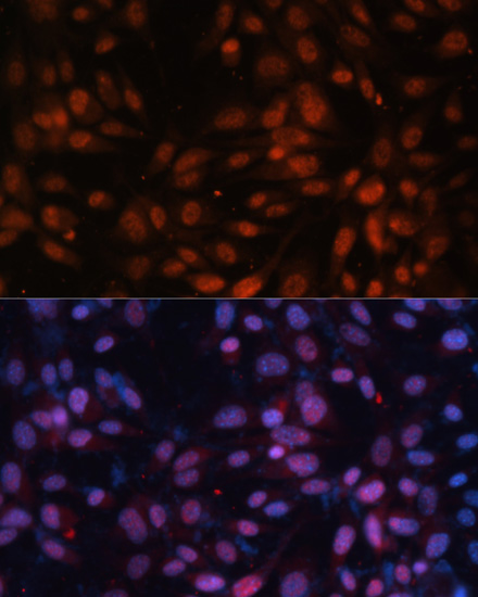 Immunofluorescence - ZNF574 Polyclonal Antibody 