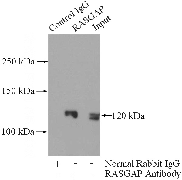 IP Result of anti-RASA1 (IP:Catalog No:114474, 4ug; Detection:Catalog No:114474 1:500) with mouse testis tissue lysate 4000ug.