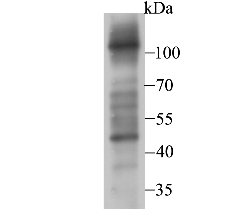 Fig1: Western blot analysis of FBXL18 on PC-3M cell lysate using anti-FBXL18 antibody at 1/500 dilution.