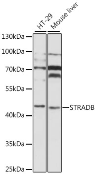 Western blot - STRADB Polyclonal Antibody 