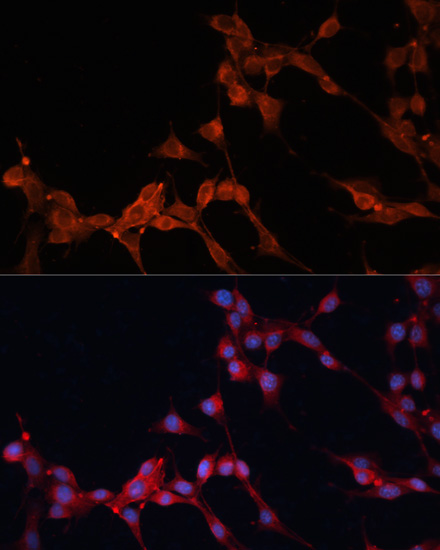 Immunofluorescence - SLC25A38 Polyclonal Antibody 
