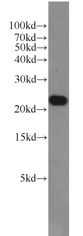 HeLa cells were subjected to SDS PAGE followed by western blot with Catalog No:108364(BAX antibody) at dilution of 1:2000