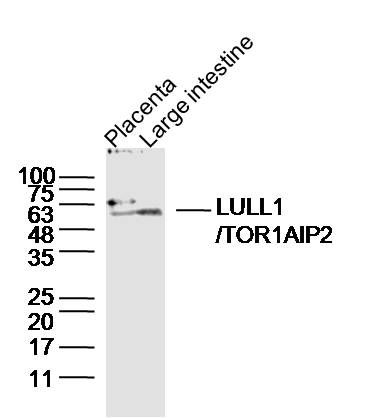 Fig1: Sample:; Placenta (Mouse) Lysate at 40 ug; Large intestine (Mouse) Lysate at 40 ug; Primary: Anti-LULL1/TOR1AIP2 at 1/300 dilution; Secondary: IRDye800CW Goat Anti-Rabbit IgG at 1/20000 dilution; Predicted band size: 51kD; Observed band size: 56kD