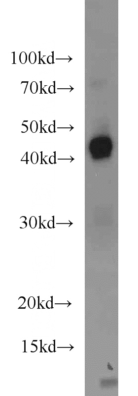 human placenta tissue were subjected to SDS PAGE followed by western blot with Catalog No:111610(IDO1 antibody) at dilution of 1:1000