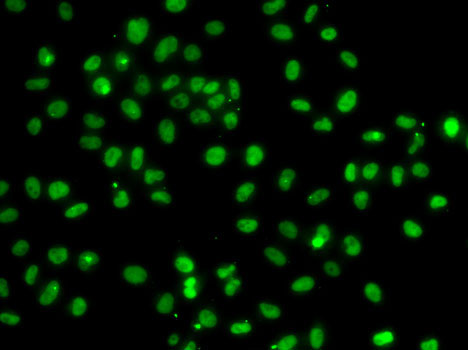 Immunofluorescence - PMS2 Polyclonal Antibody 
