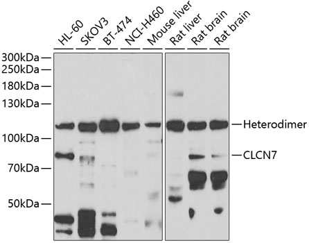 Western blot - CLCN7 Polyclonal Antibody 