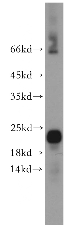 mouse skeletal muscle tissue were subjected to SDS PAGE followed by western blot with Catalog No:111701(HSPB7 antibody) at dilution of 1:400
